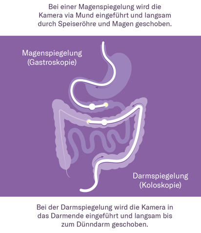 Gesund altern: Wichtige Check-ups fr Magen und Darmgesundheit Gesund altern: Wichtige Check-ups fr Magen und Darmgesundheit